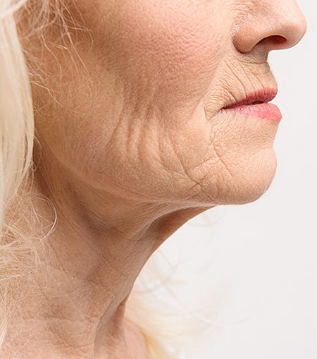 Signs of ageing Signs of ageing