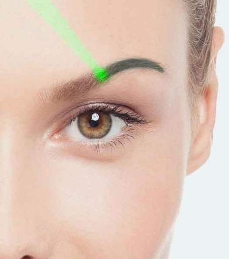 Eyebrow Cosmetic Tattoo Removal Eyebrow Cosmetic Tattoo Removal
